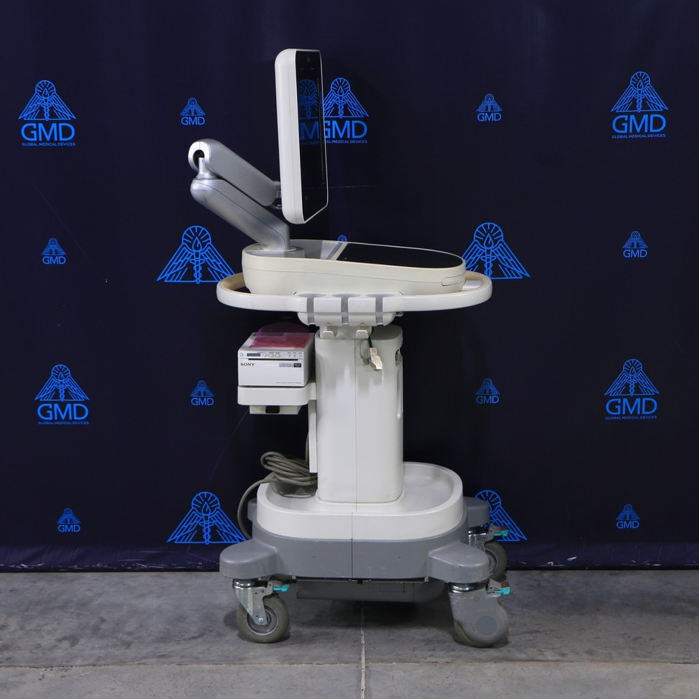 Philips Sparq Ultrasound System