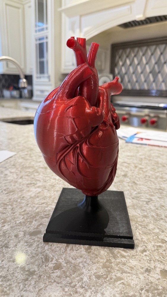 3D printed Anatomical Heart model