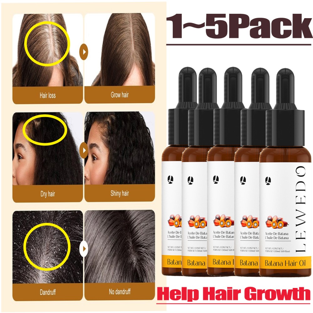 100% Pure Herbal Hair Growth Oil Shampoo Anti hair Loss Hair Regrowth Treatment