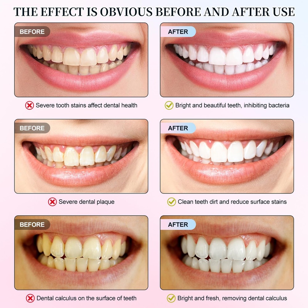 Niacinamide Whitening Toothpaste, Niacinamide Toothpaste, Effectively Whitens...