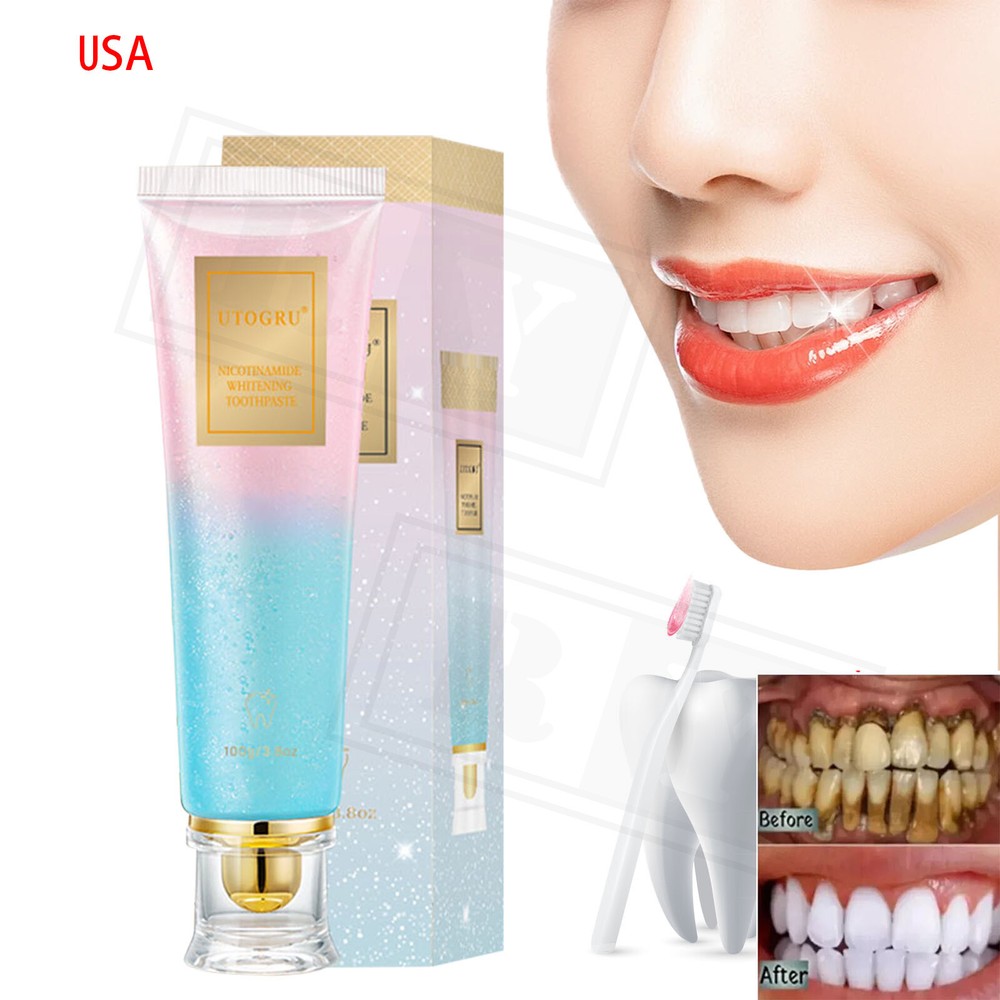 Whitening Toothpaste Natural Niacinamide Toothpaste Teeth Whitening Toothpaste
