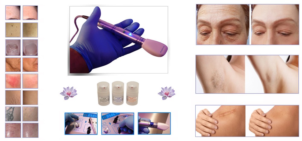 Multi-Function IPL Salon Beauty Treatment System & Accessory Kit + Machine.