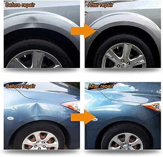 Paintless Dent Repair Kit with Bridge Puller - Effortless Dent Removal