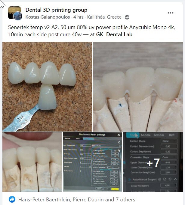 DLP SLA LCD 3d printer temporary teeth resin ..