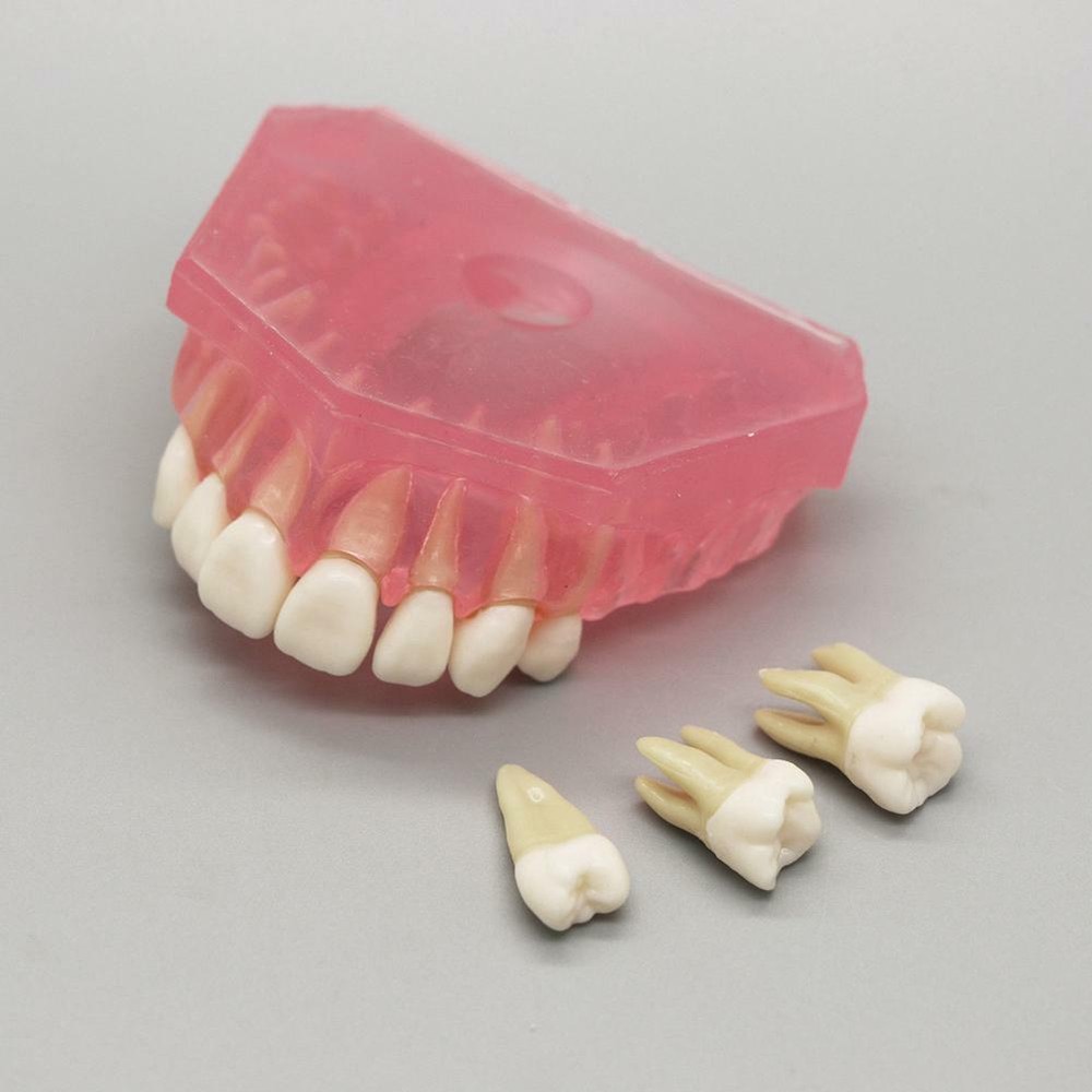 Dental Orthodontic Typodont Plastic Teeth Model 4004 Removable Teeth Standard