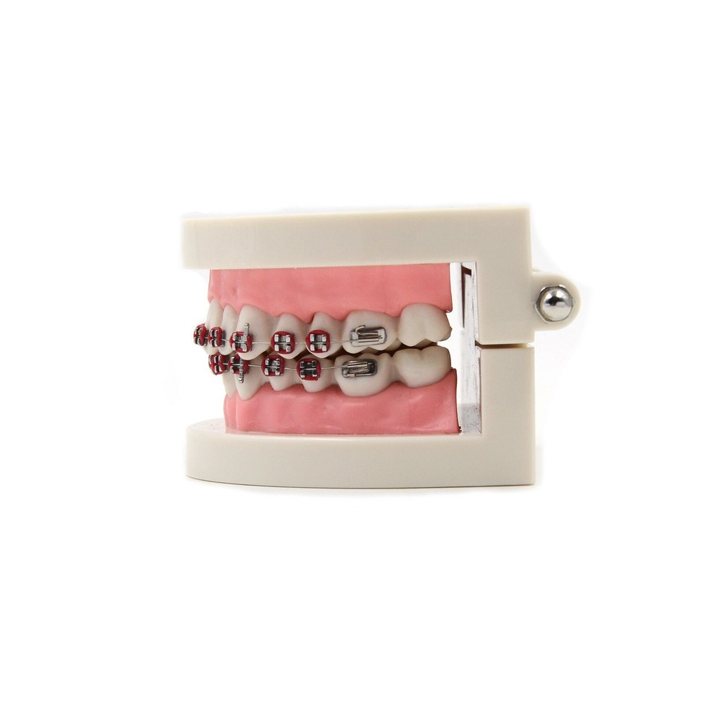 Dental Teach Typodont Demonstration Teeth Model with Braces For Patient Study