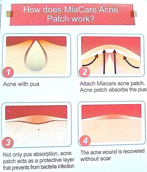 [ COSRX ] Acne Pimple Master Patch (24 patches) 1 Sheet ~10 Sheets