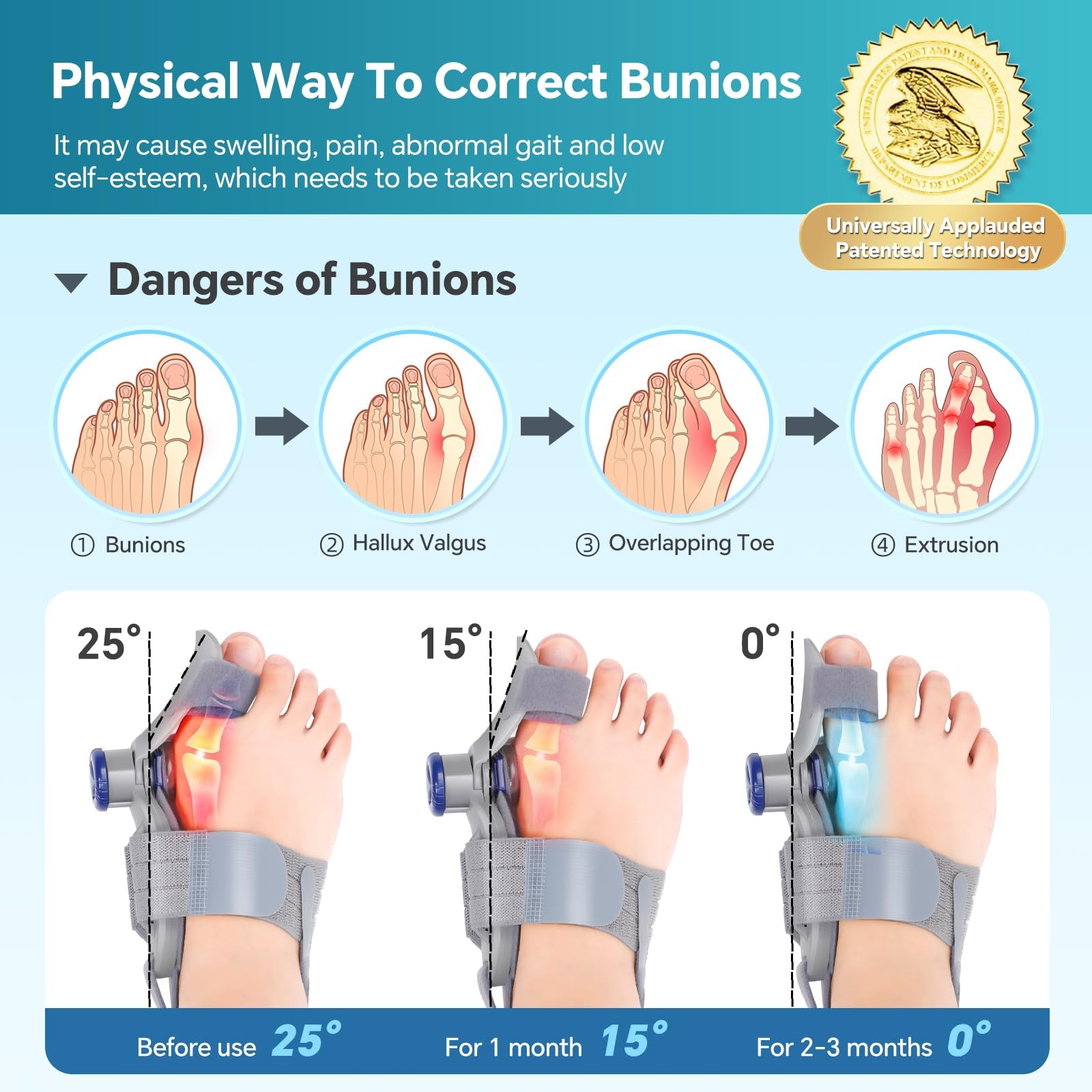 2PCS Bunion Corrector for Women & Men, FSA Approved Products Only, Adjustable Bu