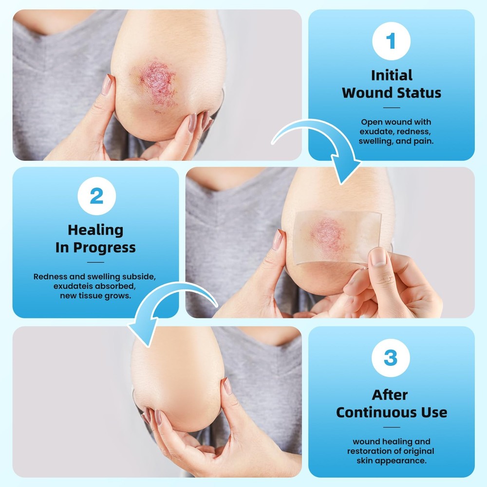 Hydrocolloid Roll Bandages, 2IN x 5FT Extra Large * 5FT, Translucent