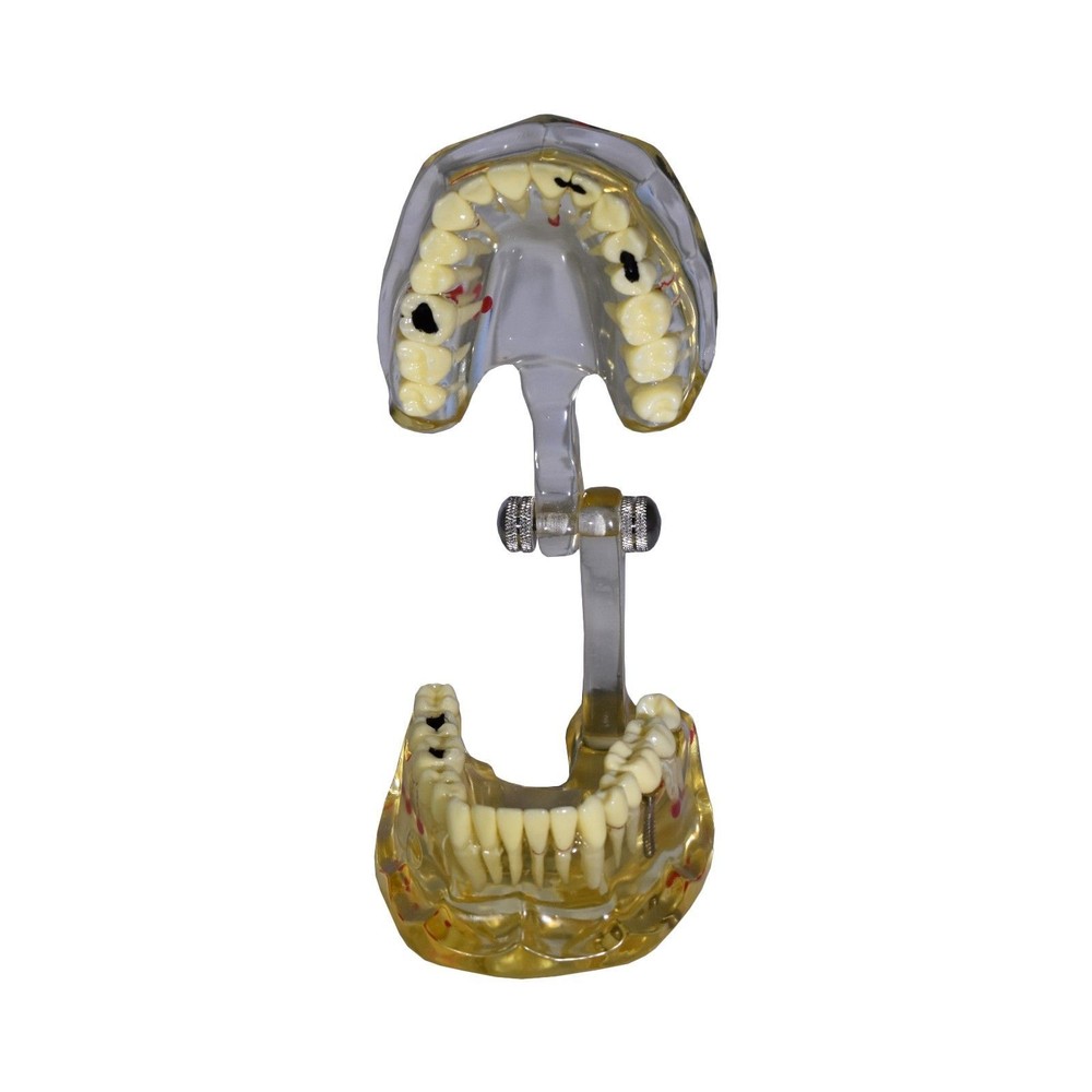 (Redland) Dental Demonstration Teeth Educational Model #1075