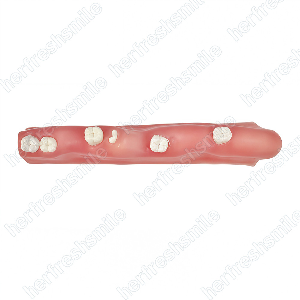 Dental Impacted Tooth Model Wisdom Unerupted Tooth Extraction Practice Training