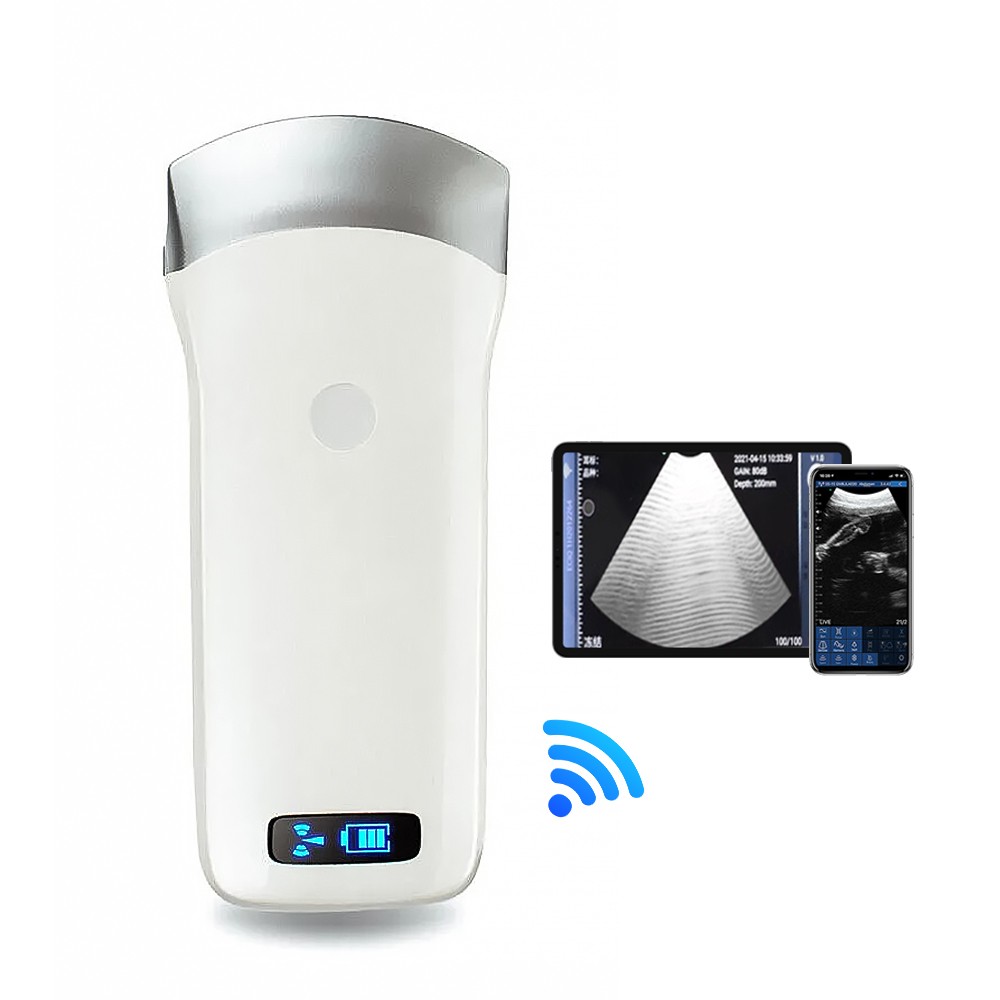 Portable 80/64 element Wireless Ultrasound Scanner Machine Android iOS Windows