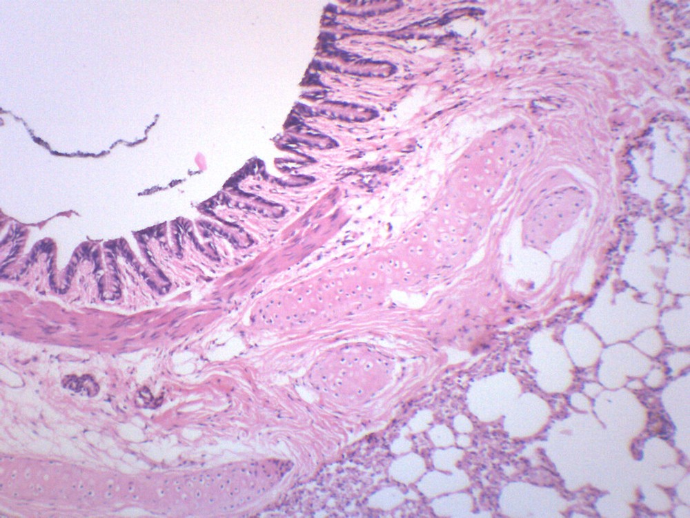 Human Lung Section - Prepared Microscope Slide - 75x25mm - Eisco Labs
