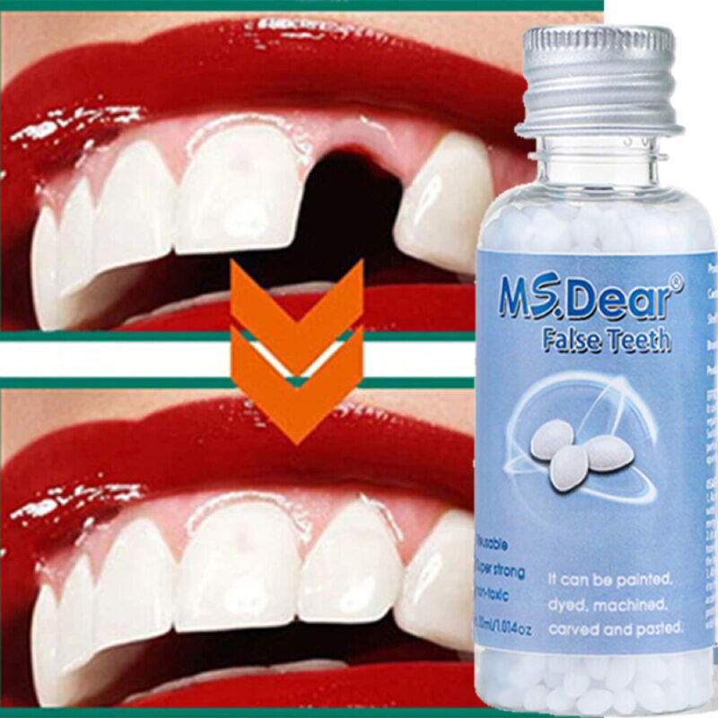 Temporary Tooth Repair Kit Teeth Gaps False Teeth Solid Glue Denture Adhesive