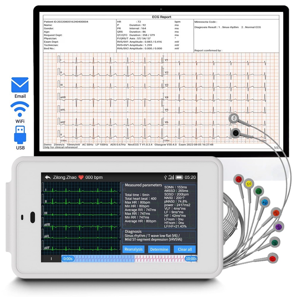 6/12 Lead Portable ECG Machine w/ Glasgow ECG Algorithm, Email/WiFi/USB Transfer
