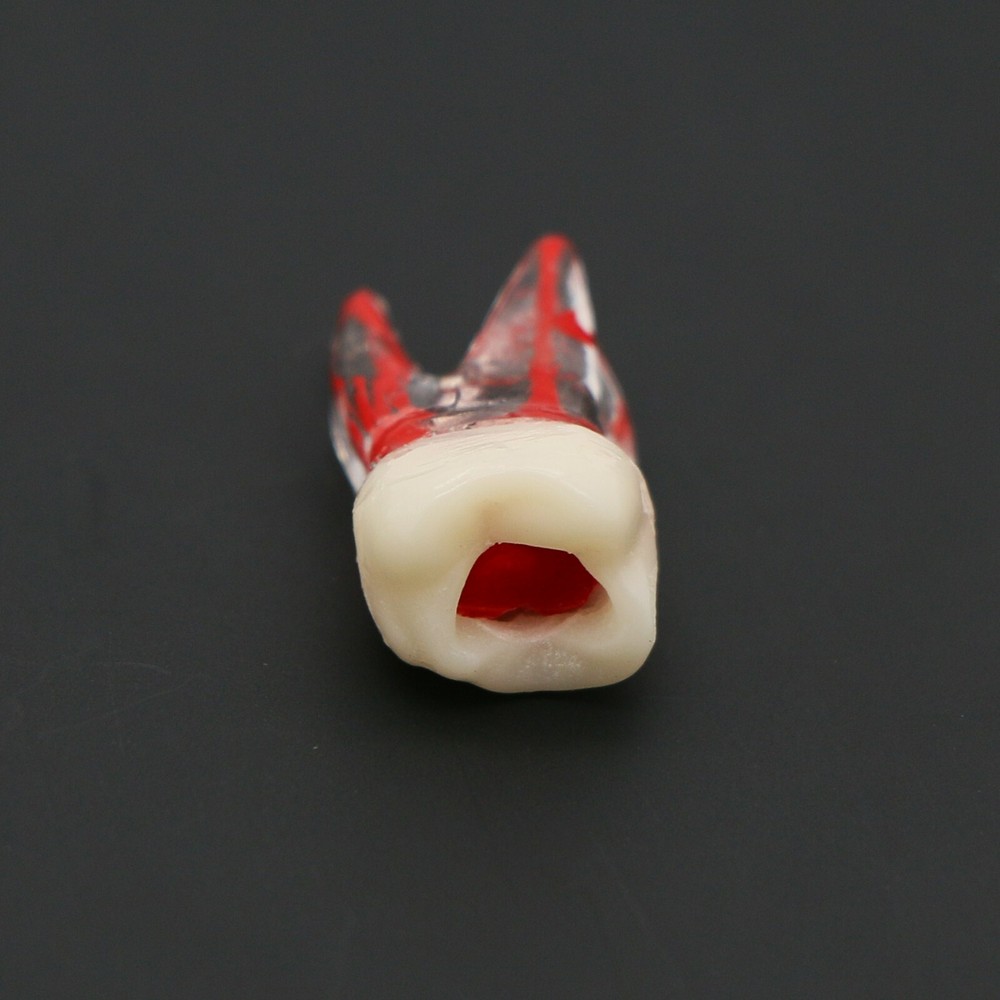 Dental Molar Endo Root Canal Study Model RCT/MTA Practice Block Pulp Cavity