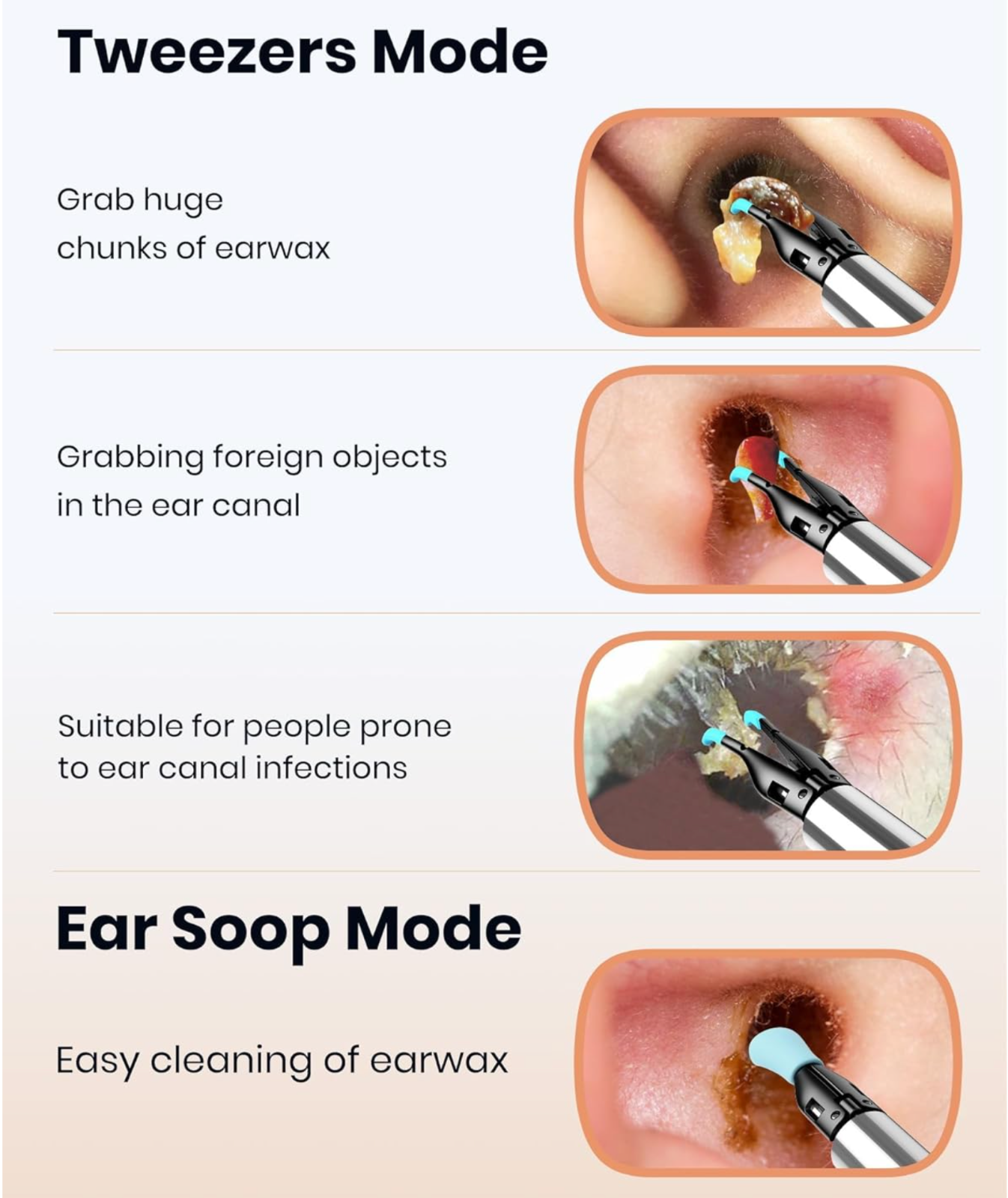 BEBIRD Note5 Pro Visual Smart 10 Megapixel HD Ear Wax Removal Endoscope Camera
