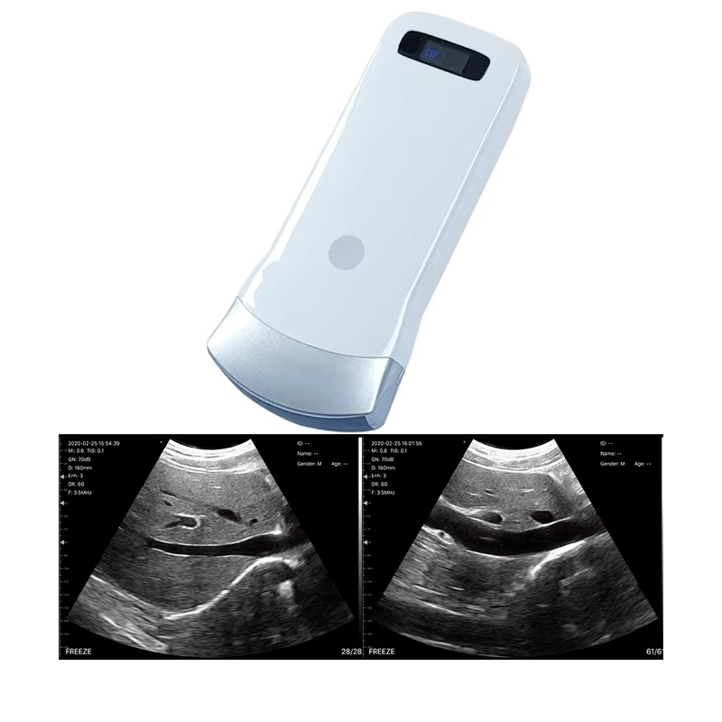 IOS Android Windows 80 Elements Convex Array Wireless Ultrasound Scanning Probe