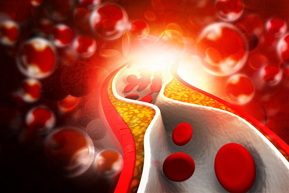 Immune support - CHOLESTEROL RELIEF FORMULA - cholesterol garlic - 2B