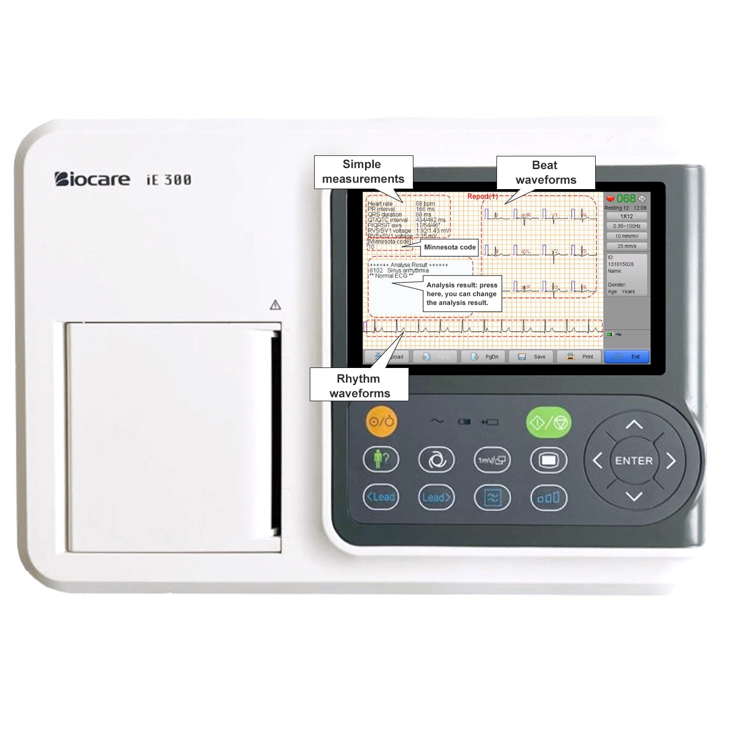 Biocare 12 lead ECG Machine Portable with Au-to Analysis Diagnosis ECG, Printer