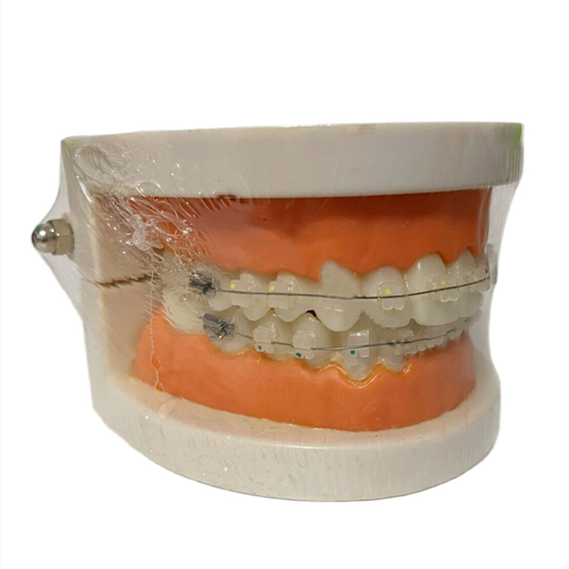 Dental All Ceramic Brackets Study Model Retainer Clear Bracket Orthodontic Model