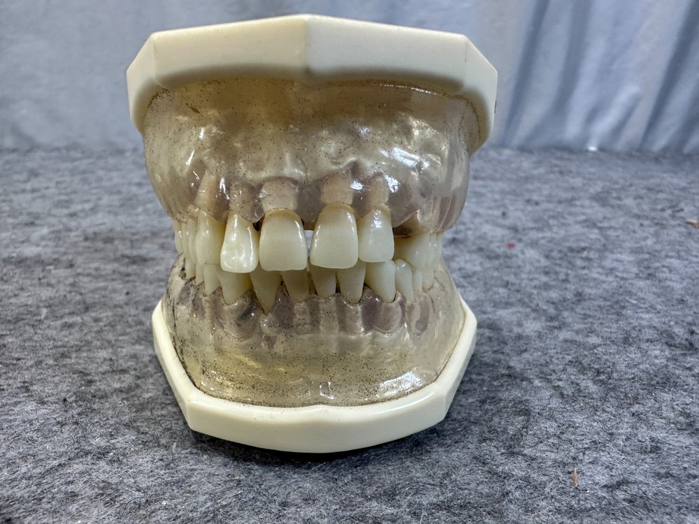 Perio Trainer Dental Model with Hinge Clear Composite gums