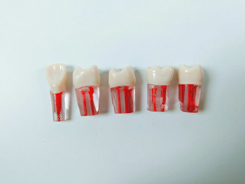 5pcs Dental clear Root Canal Teeth Study Practice Model for Endodontic Pulp File