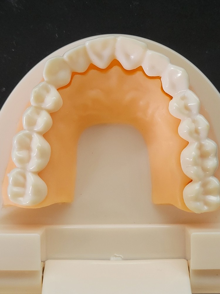 Dental Typodont Study Model - Fixed Teeth