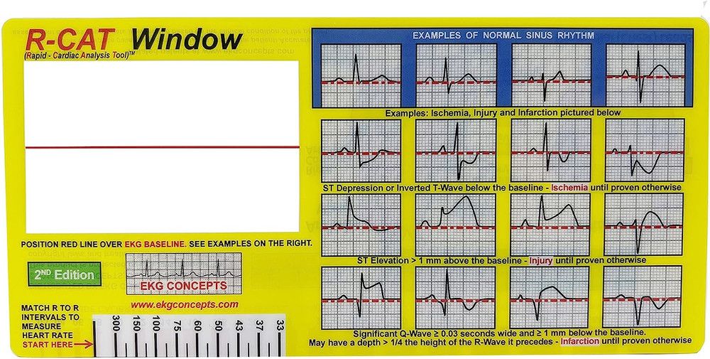 EKG Window: Second Edition