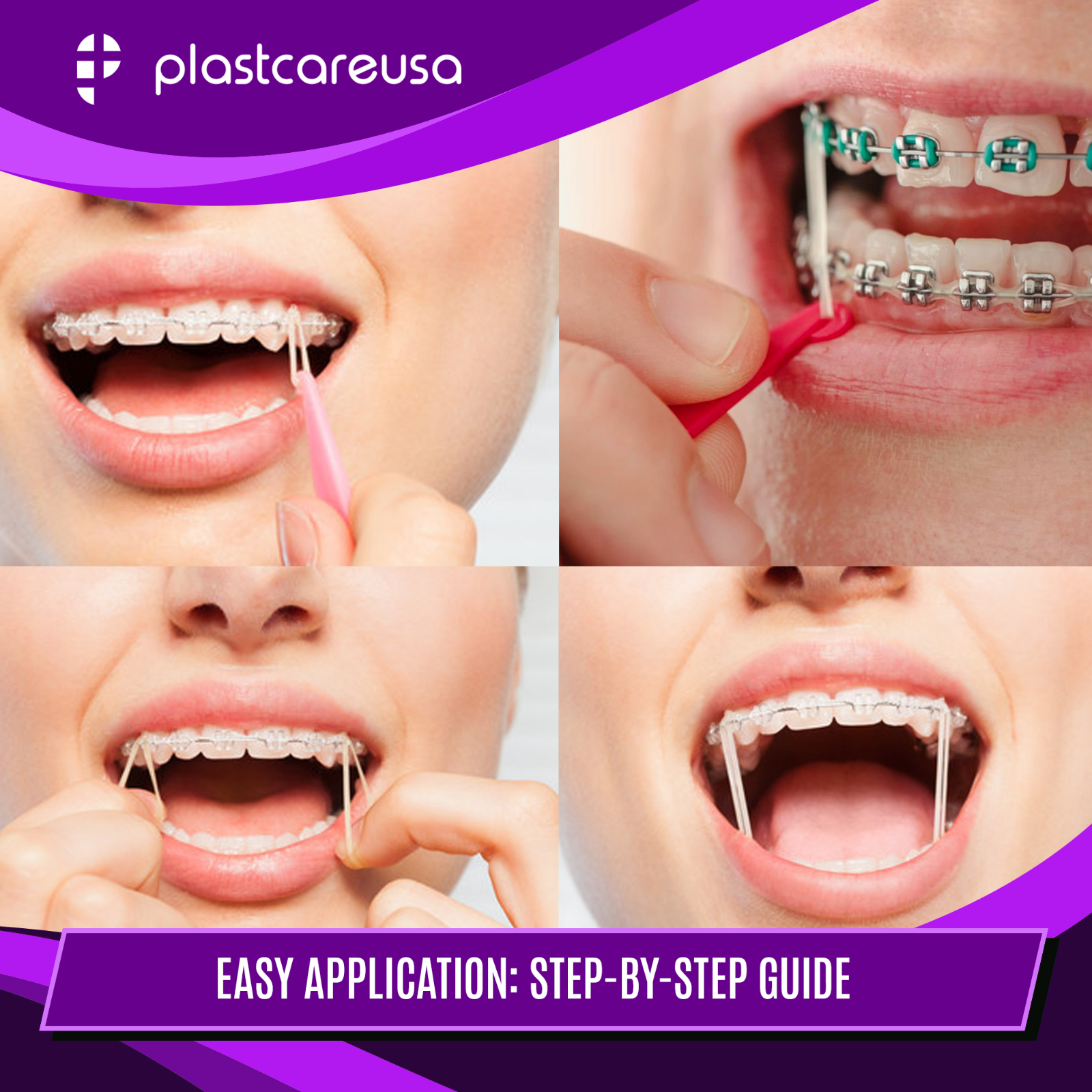 Assorted Colors Latex Elastic Rubber Bands for Orthodontic Dental Braces Teeth