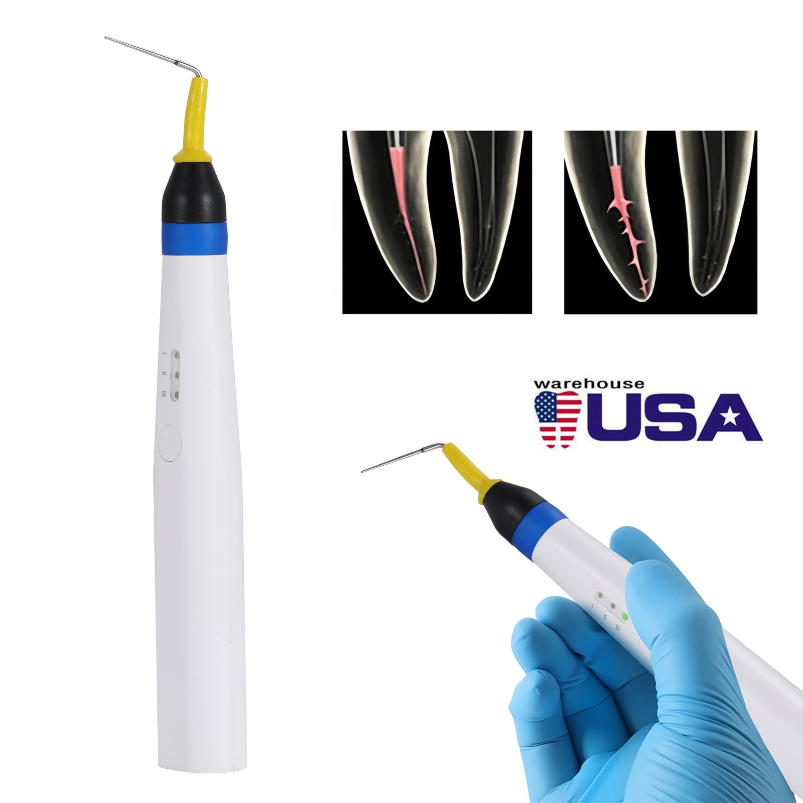 Dental Cordless Endo Heated Pen Gutta Percha Obturation System/2pcs Heated tips