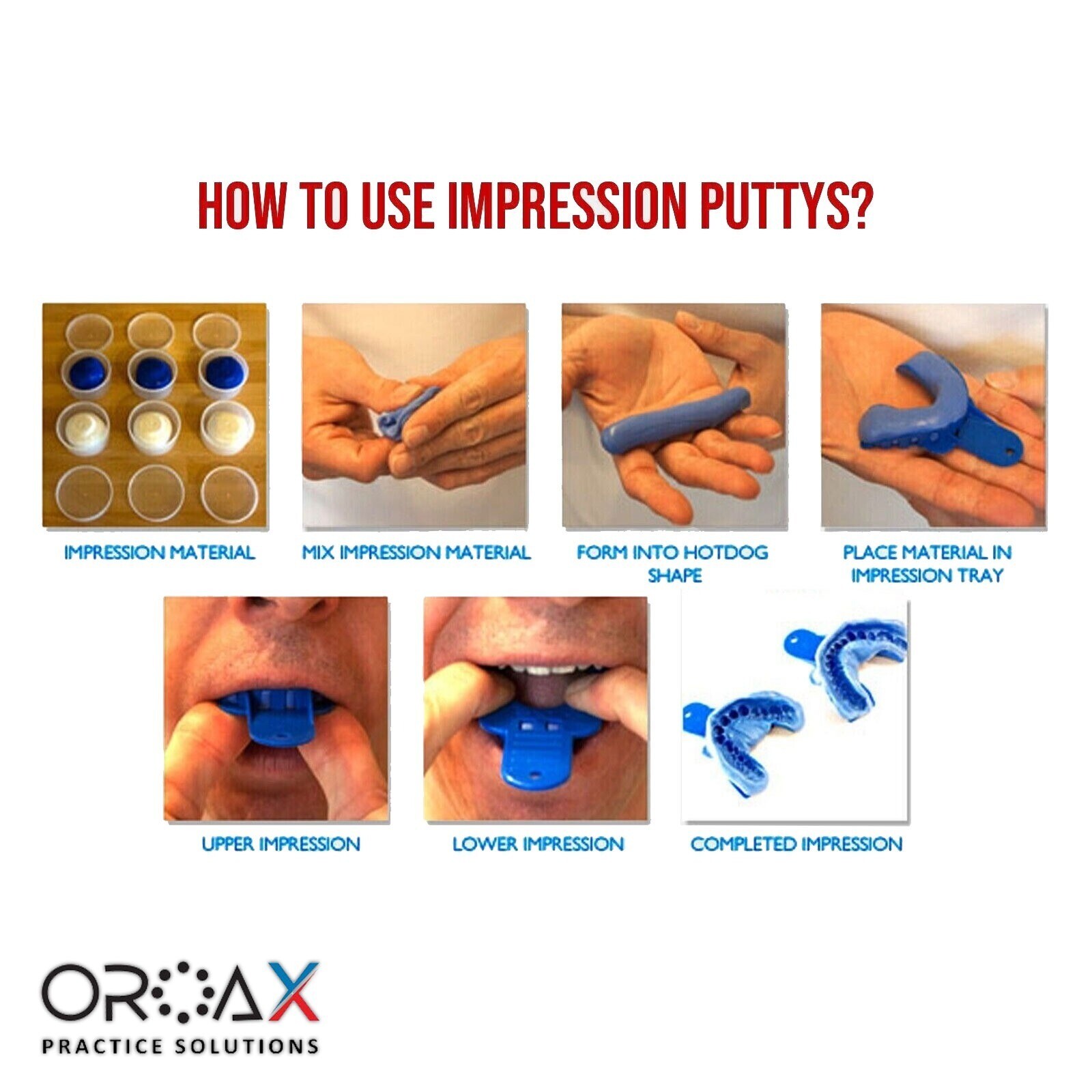 Dental Impression Putty Teeth Mold Kit Large Upper & Lower Impressions Trays