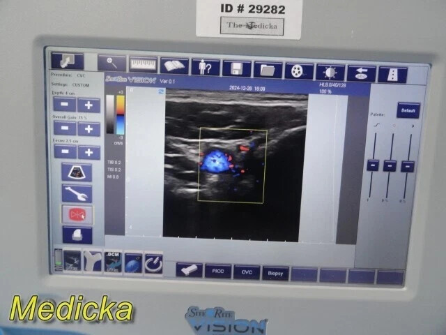 Ultrasound Imaging Probe – Linear Type | Model 128WB (Ref 9770033) ~ 36620