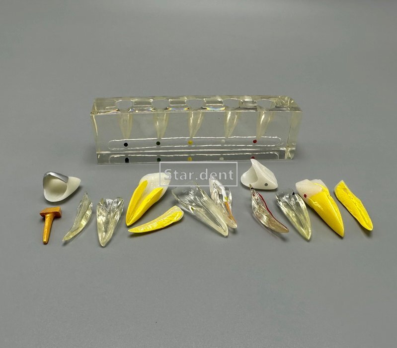 Dental Caries Teeth Model Detachable Abutment Teaching Study Models 4 times