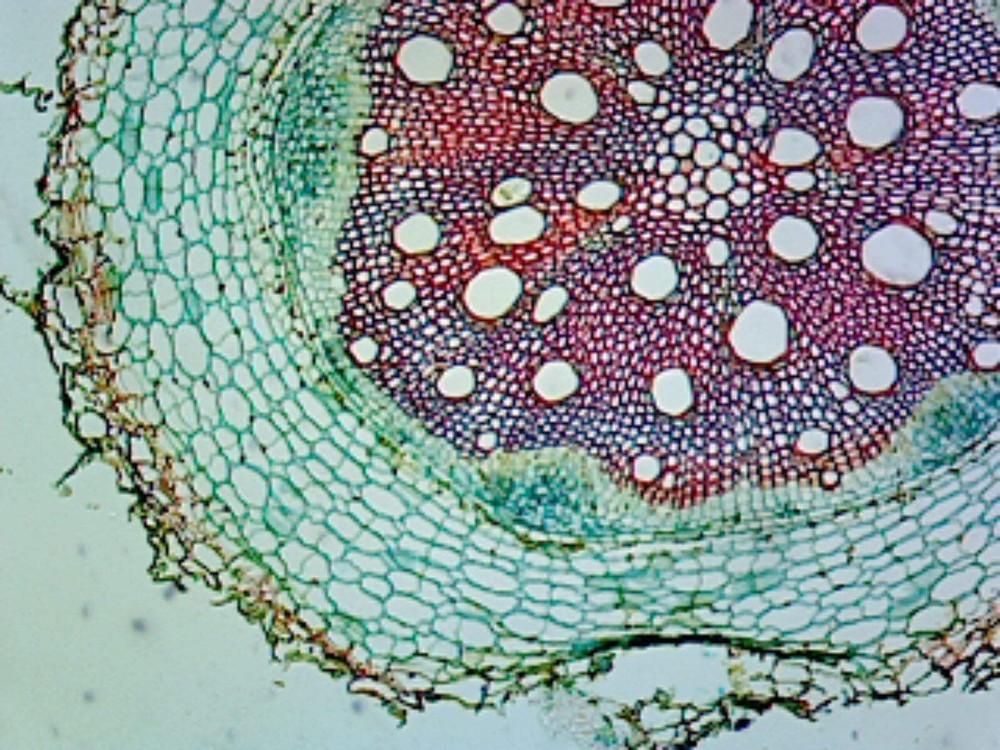 Sunflower (Helianthus) Stem; Typical Monocot Stem; Cross Section