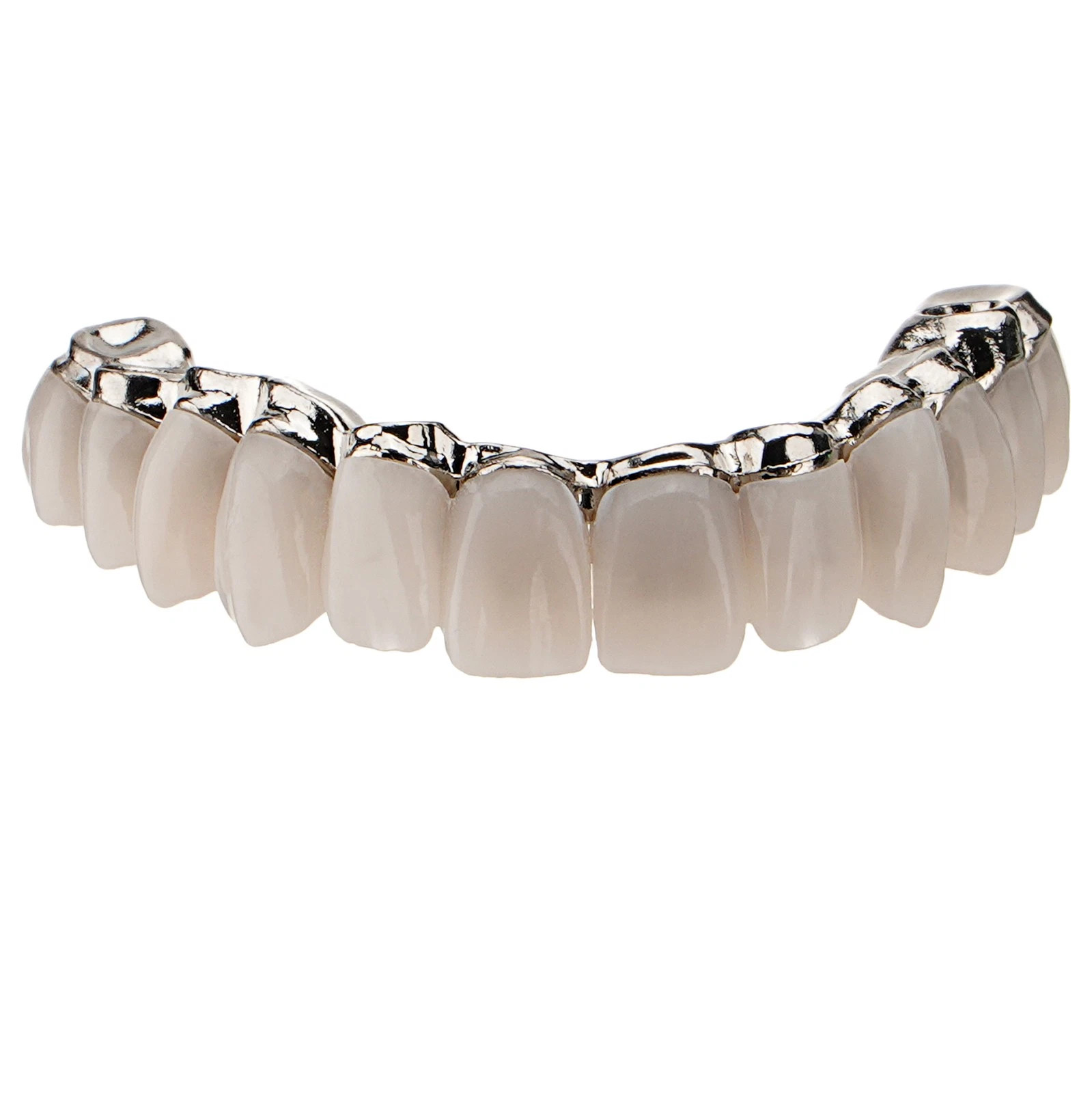 Dental All-on-4 Overdenture Model Dental Upper Jaw Implants Restoration 4 Screws