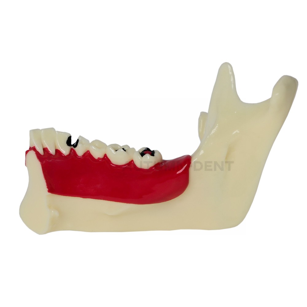 Dental Mandibular Tissue Teeth Anatomical Model Patient Teach Study Education