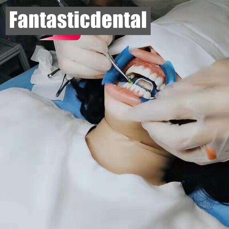 4.5g Dental Composite Resin Light Cure Bright White Veneer Hybrid Aesthetic