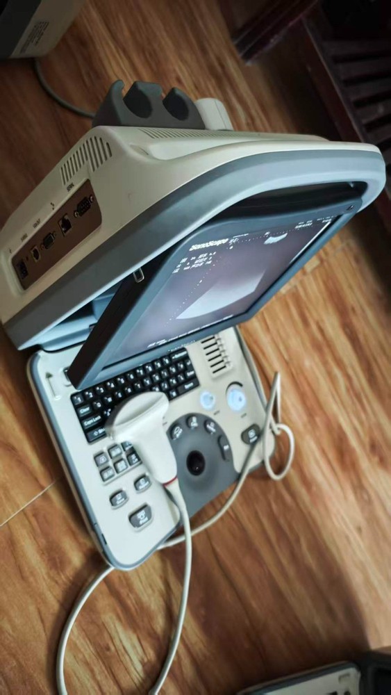 SonoScape A5 Portable Ultrasound