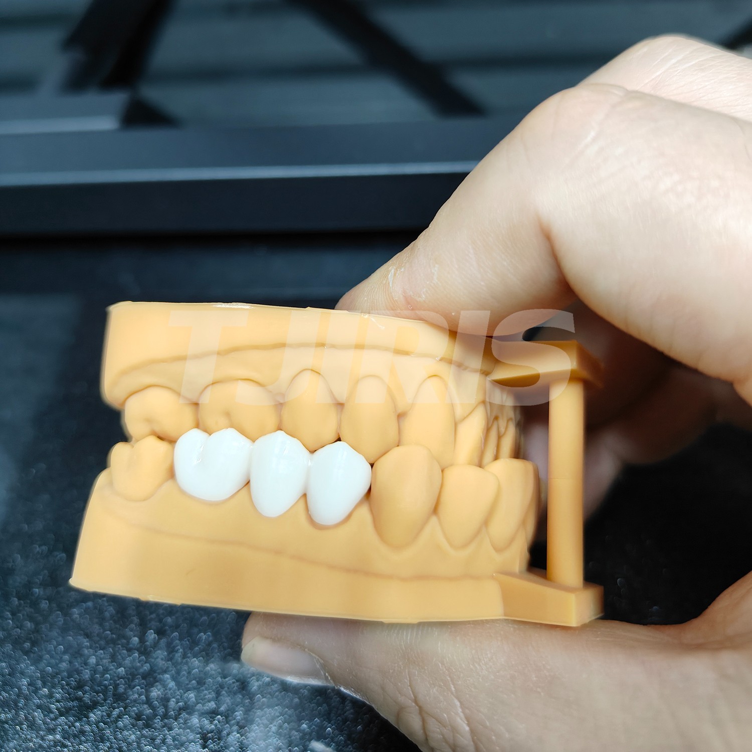 Dental Temporary Crown & Bridge 3D Printing Resin for LCD DLP Printer 1kg