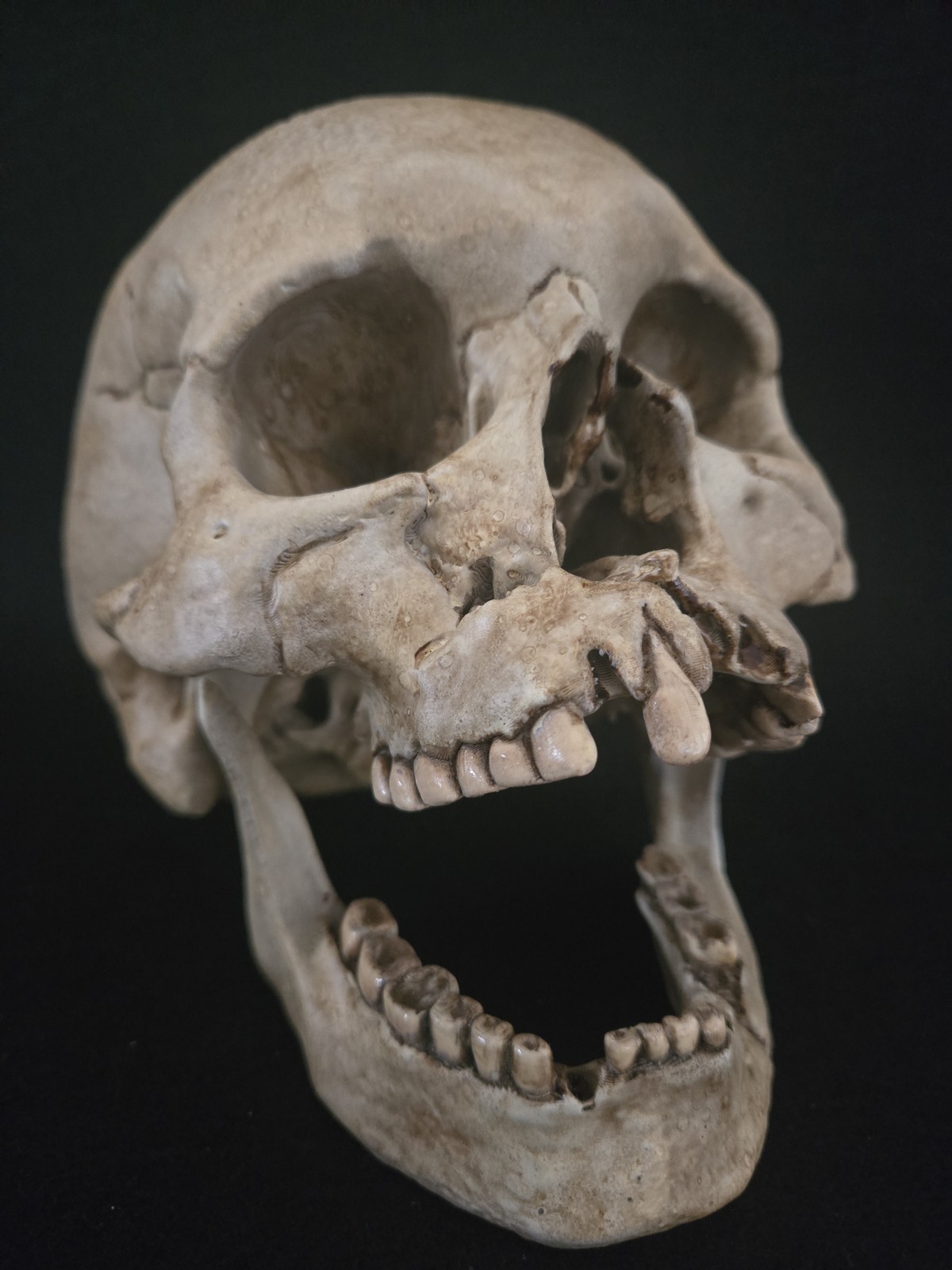 Human Skull Life Size Replica with battle wounds Realistic - Momento Mori