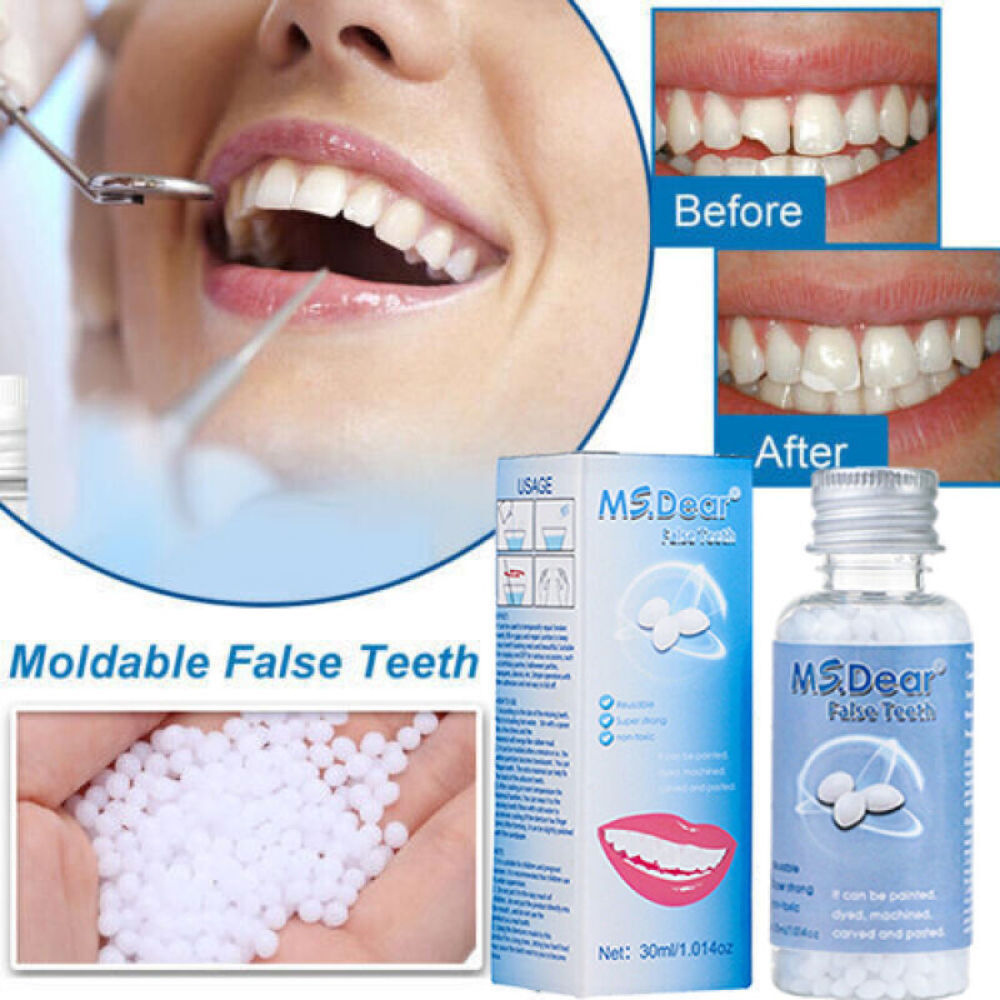 Tooth Repair Kit Temporary Teeth Replacement Beads for Missing & Broken Teeth