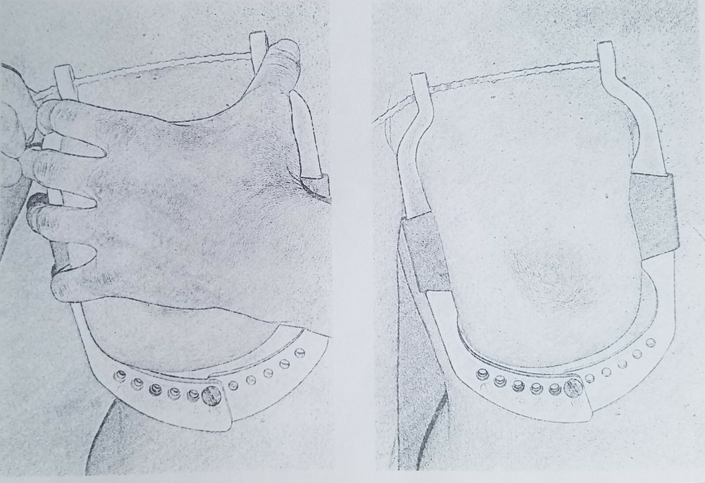 Drop & Fluff Eliminate Breast Augmentation Capsular Contracture