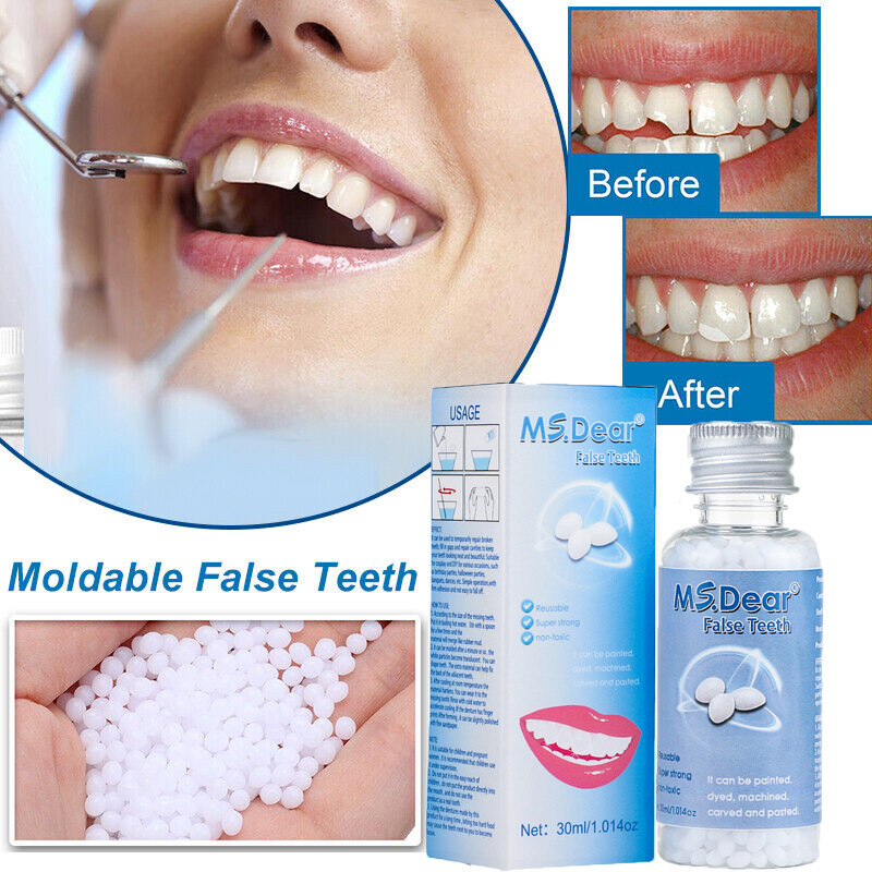 Tooth Solid Gel Temporary Repair Kit Moldable Thermal Fitting Bead Teeth 30ml