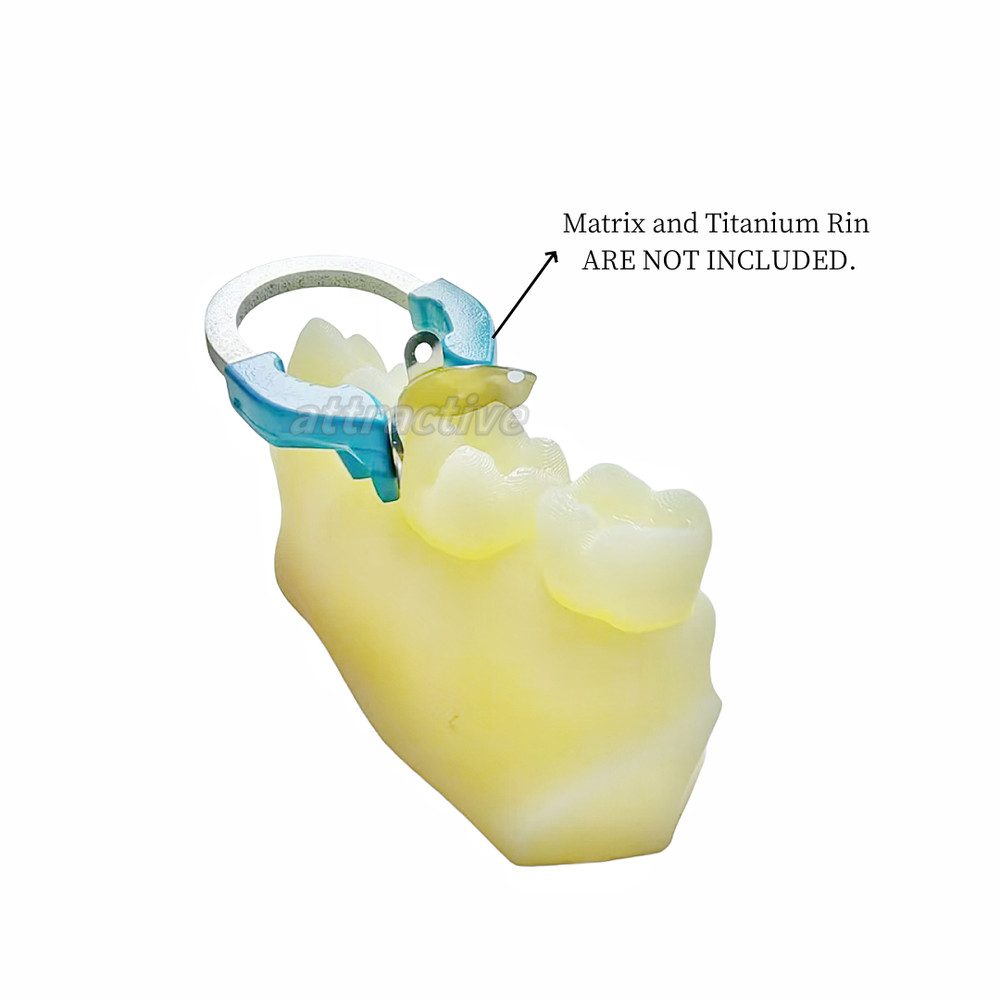 Dental Caries Decay Teeth Model Composite Resin Restore Tooth Simulate Class Ⅱ