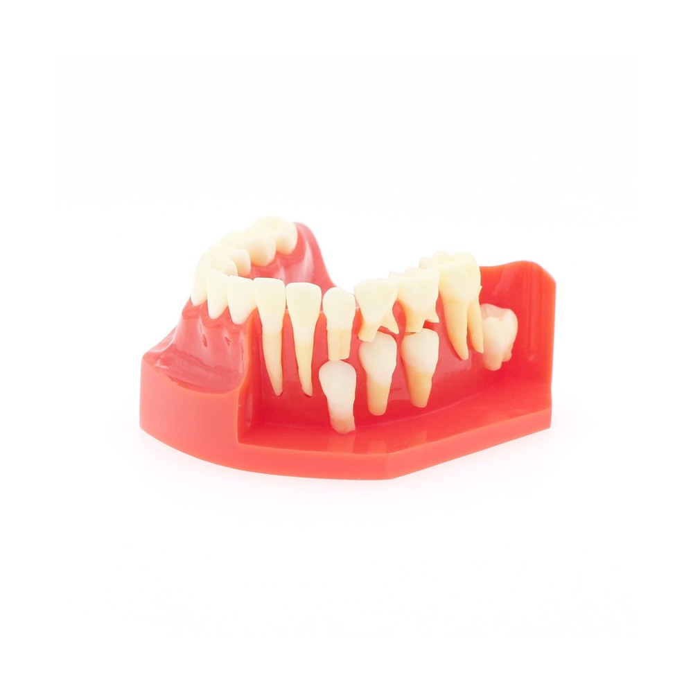 Teeth Typodonts Dental Model #7013 - Teeth Eruption Development Model Alterna...
