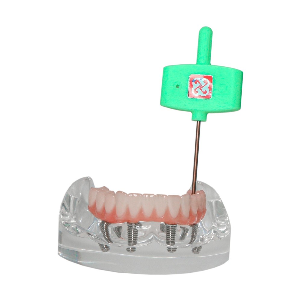 Upper/Lower Dental Typodont Implant Model with Detachable Post Core Bridge&Screw