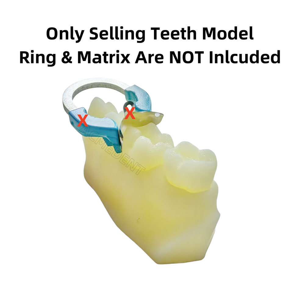 Dental Caries Decay Teeth Model Tooth Simulate Class Ⅱ Resin Restore Template