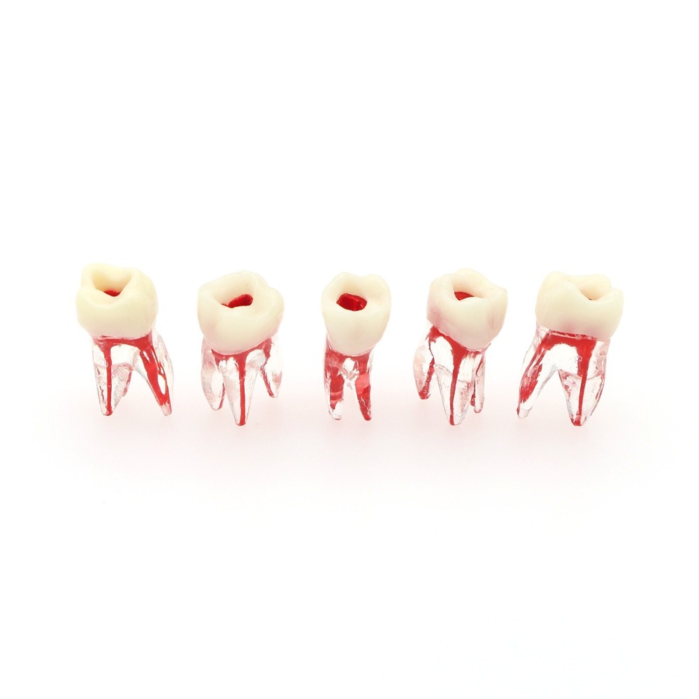 Dental Root Canal Practice Teeth Model for Pulp Study RCT Endo File Teach Study