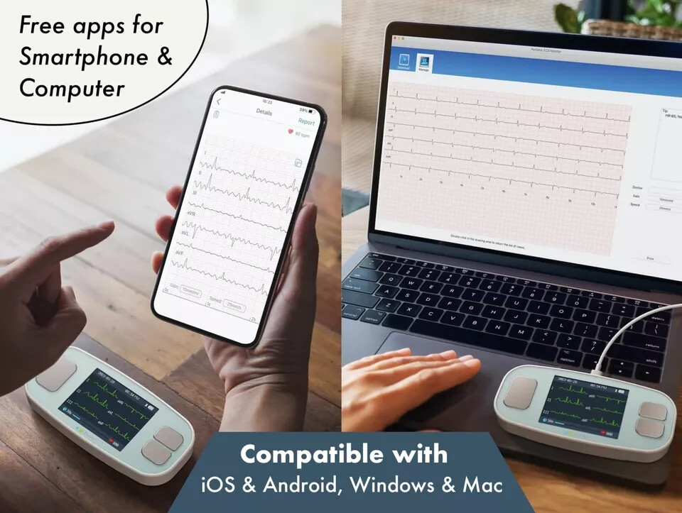 EMAY 6Leads Portable ECG Monitor Record ECG and Heart Rate in 6 Channels